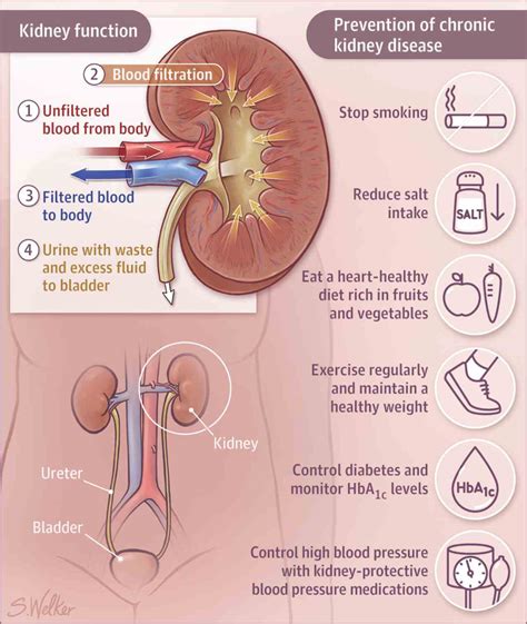 World Kidney Day: Are you taking good care of your kidneys? Here's how you can – Firstpost