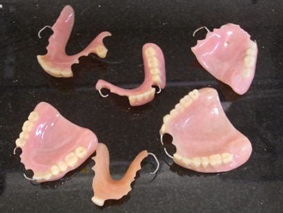 Upper Partial Dentures | Free HD Wallpapers