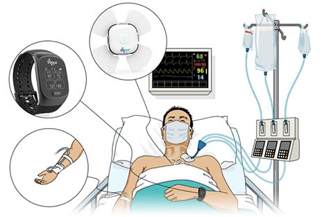 Frontiers | A Pilot Study of Blood Pressure Monitoring After Cardiac Surgery Using a Wearable ...