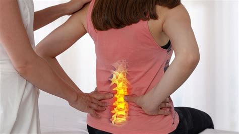 Fix Straightening of Lumbar Lordosis, Follow These 5 Top Exercises