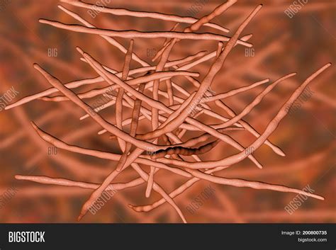 Actinomycetes, Gram- Image & Photo (Free Trial) | Bigstock