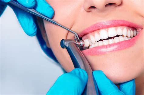 #HealthFeature: Six Benefits of Getting a Dental Cleaning - CNW Network