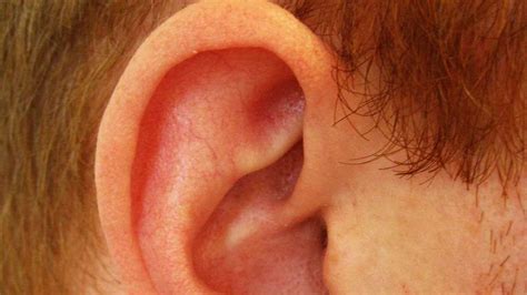 How to Tell if Ear Cartilage Is Infected - Howcast