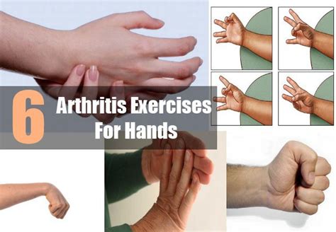 Arthritis Exercises For Hands | Arthritis exercises, Arthritis ...