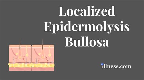 Localized Epidermolysis Bullosa : Overview, Causes, Symptoms, Treatment ...