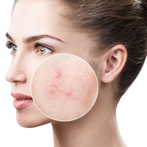 Dermatologists in Clearwater FL | Clear Skin Dermatology