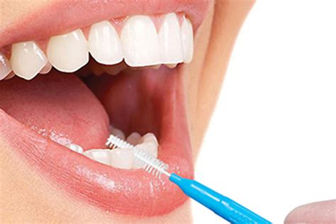 How Do You Use Interdental Brushes? - Piksters