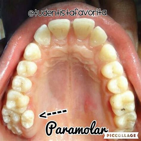 Pin on ODONTOLOGY