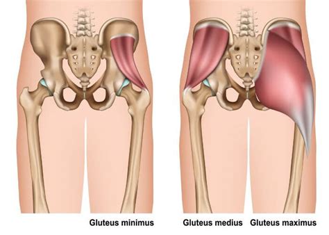 Abductor Repair | Gluteus Medius Minimus Treatment| Orthopedic Hip ...