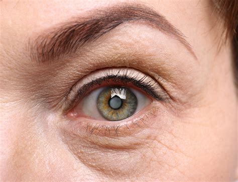 5 Facts About Diabetes and Your Eyes – LASIK Denver | Cataract Surgery