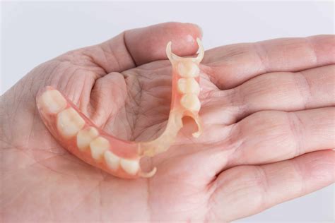 Why choose flexible partial dentures over traditional | EVDP