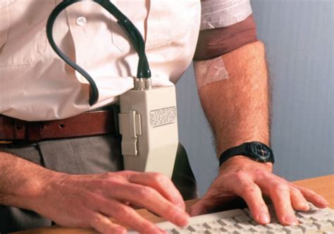 Ambulatory blood pressure monitoring: from guideline into practice ...