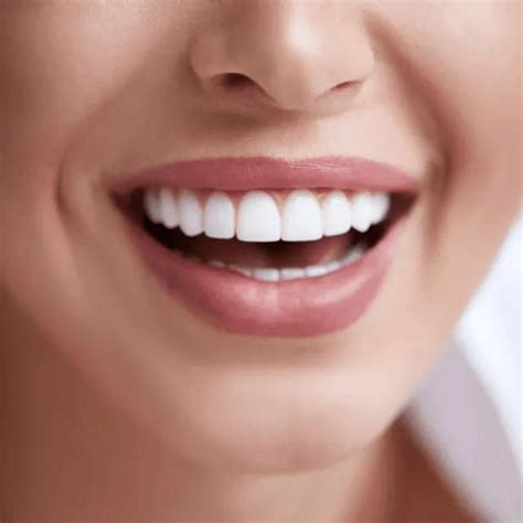 Teeth Whitening Kits - Brow Sister