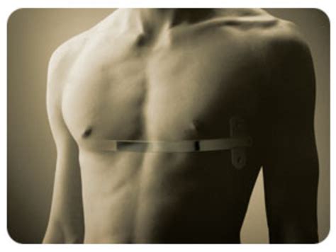 Pectus Excavatum PostOperative Care - Maintaining Chest Appearance after Surgery | HubPages