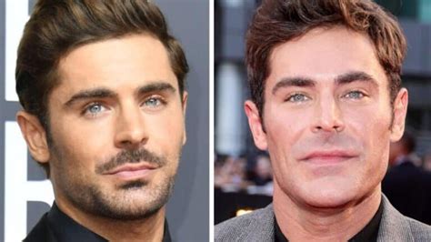 Zac Efron Face Accident: Did He Have A Plastic Surgery?