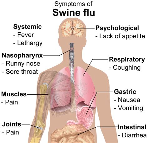 File:Symptoms of swine flu.png - Wikimedia Commons