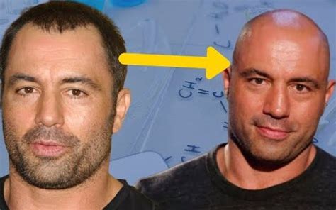 The Story Behind Joe Rogan's Hair Transplant - Hair System