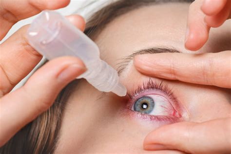 Eye Injuries – Symptoms & Treatment
