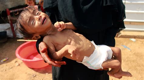 Yemen in 'a desperate situation' as famine looms and hundreds of thousands face starvation ...