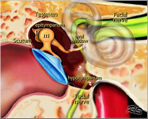 Scutum Temporal Bone