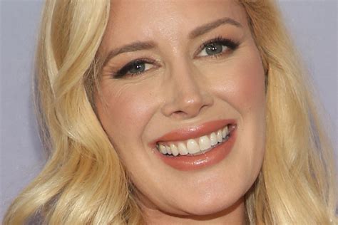 Heidi Montag Before and After: From 2006 to 2022 - The Skincare Edit