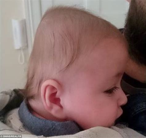 Kind stranger transforms the life of baby born with flat head syndrome | real fix