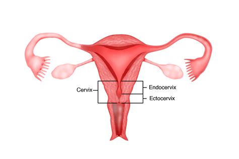 Chapter 13 – Cancer of the Cervix – Melaka Fertility