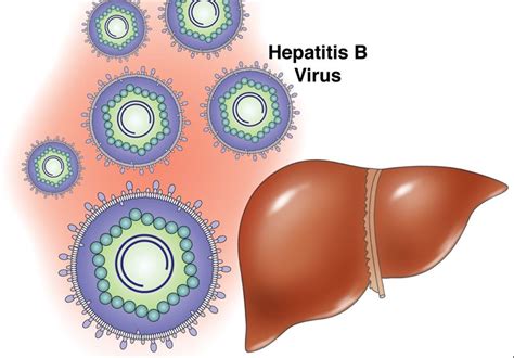 Stone Age Hepatitis B Virus Decoded - Science news - Tasnim News Agency