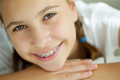 HOW MUCH DO BRACES COST FOR CHILDREN? | Dental braces, Dental clinic, Dentist