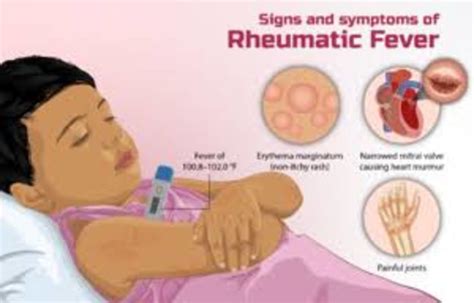 Rheumatic Heart Disease Levels of Prevention - HubPages