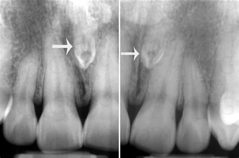 Locate the Object: September 2014 – Dr. G's Toothpix