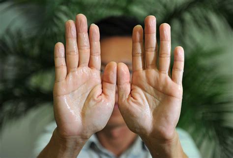 Five major remedies: how to get rid of clammy hands? - We Post News