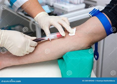 Blood Sampling Procedure for Analysis Stock Photo - Image of biotechnology, analyzing: 238189040