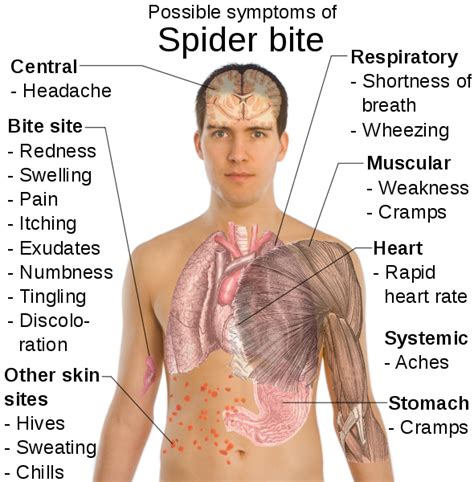 Health & Fitness: Hobo Spider Bite Symptoms