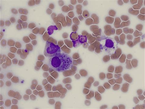 Wright's stain procedure, principle, and results