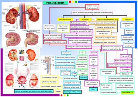 (PDF) pathway pielonefritis | Rista Agus Kurdani - Academia.edu