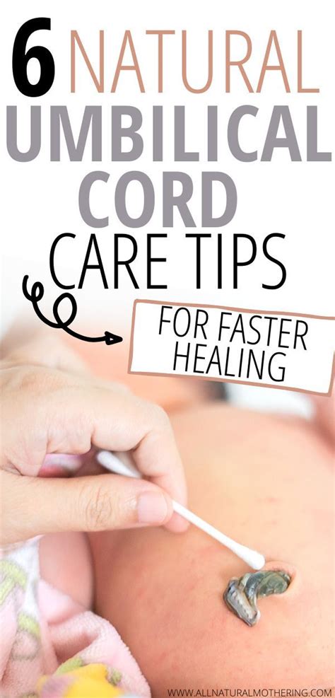 Umbilical Cord Care : Natural Remedies for Faster Healing! | Newborn baby tips, Baby care tips ...