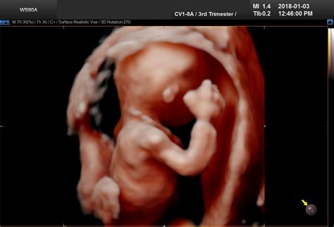 2D, 3D, 4D and UC Baby Calgary's latest 5D Ultrasound Service