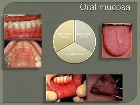 Red lesion of oral mucosa