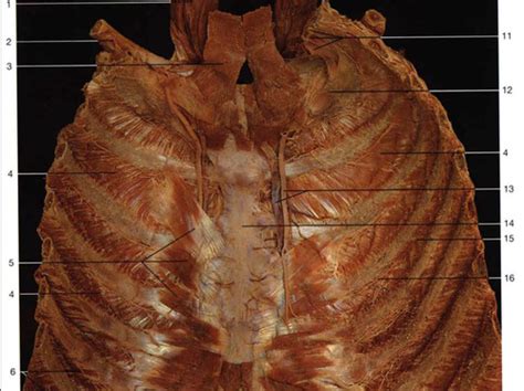 EXAM 2 - THORAX/RESPIRATORY - Anterior Thoracic Wall, Anatomy - Thorax ...