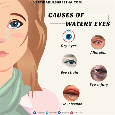 Causes of Watery Eyes – Dr Vertika Kulshrestha | Eye Specialist