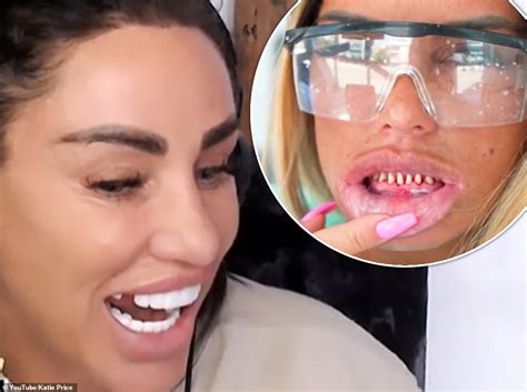 Katie Price reveals yet ANOTHER one of her Turkey veneers has fallen ...