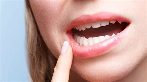 Swollen Gums: Possible Causes and Treatments - Solar Dental & Orthodontics