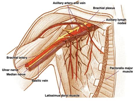 Imaging-Pathologic Correlation of Diseases in the Axilla | AJR