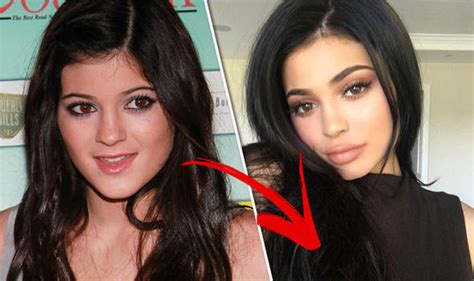 Kylie Jenner plastic surgery: Before and after | Express.co.uk