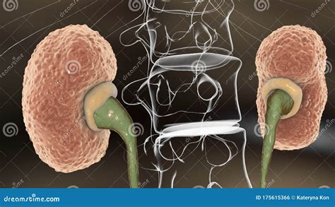 Chronic Glomerulonephritis, Gross Pathology Stock Illustration - Illustration of dilated ...