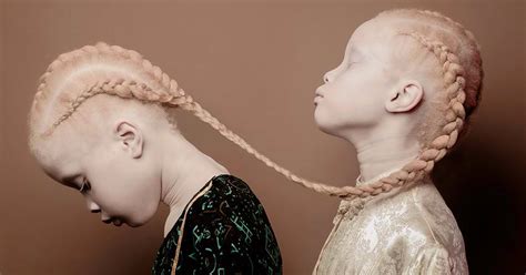 Albino Twins From Brazil Are Challenging The Fashion Industry With ...