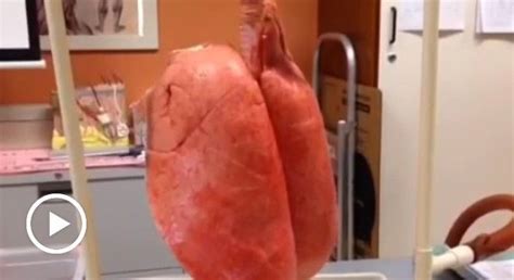 Watching A Pair Of Smoker's Lungs Vs. A Pair Of Healthy Lungs Is Pretty Crazy - Digg | Pulmão de ...