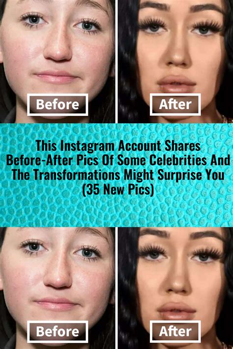 This instagram account shares before after pics of some celebrities and the transformations ...