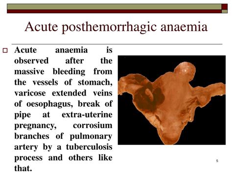 PPT - Anaemias PowerPoint Presentation, free download - ID:6163841